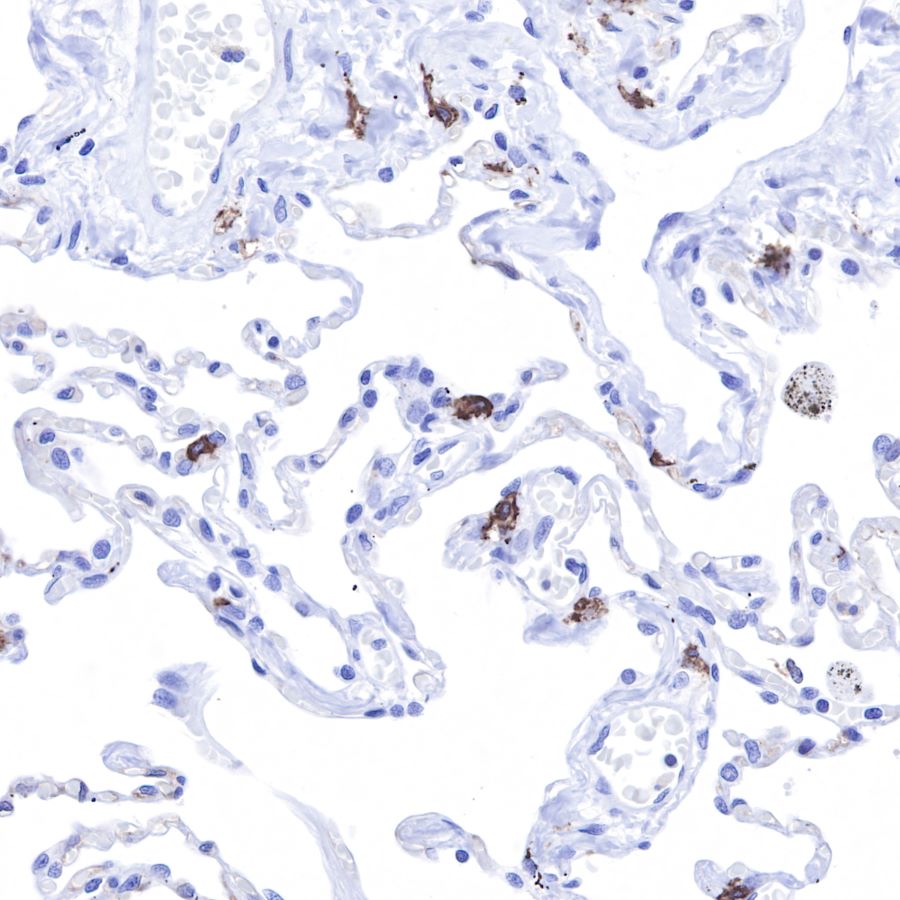 S-RMab® CD117 Recombinant Rabbit mAb,PBS Only (SDT-125-51)