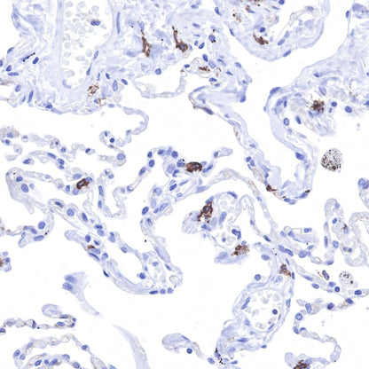 S-RMab® CD117 Recombinant Rabbit mAb,PBS Only (SDT-125-51)