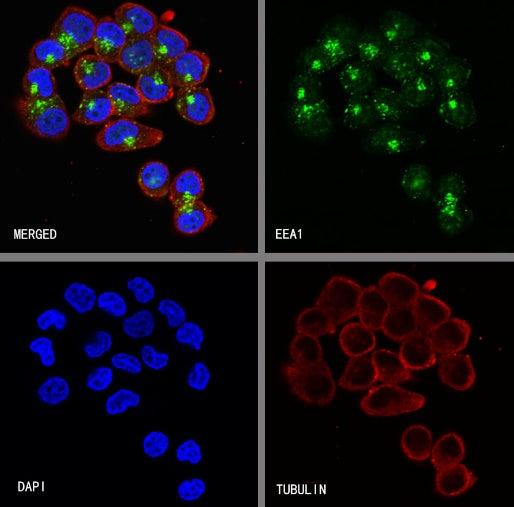 EEA1 Recombinant Rabbit mAb (S-2604-39)