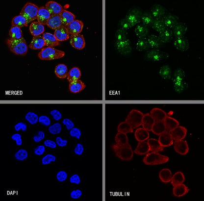 EEA1 Recombinant Rabbit mAb (S-2604-39)
