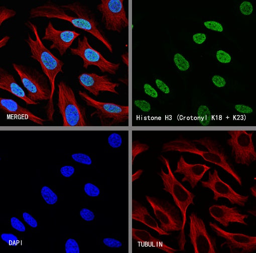 Histone H3 (Crotonyl K18 + K23) Recombinant Rabbit mAb (S-R410)
