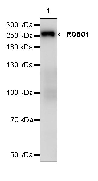 ROBO1 Recombinant Rabbit mAb (S-2931-169)