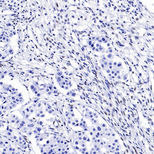 ZEB1 Recombinant Rabbit mAb