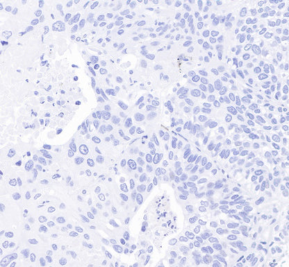 S-RMab® CD23 Recombinant Rabbit mAb (SDT-028-67)