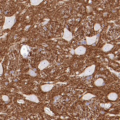 NRGN Recombinant Rabbit mAb (S-1624-60)