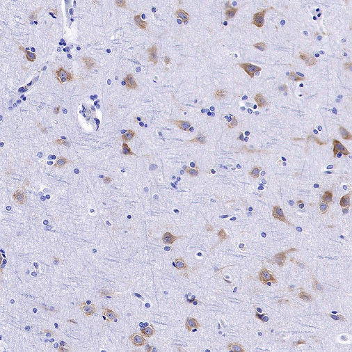 FMRP Recombinant Rabbit mAb (S-1671-1)