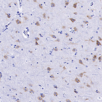 FMRP Recombinant Rabbit mAb (S-1671-1)