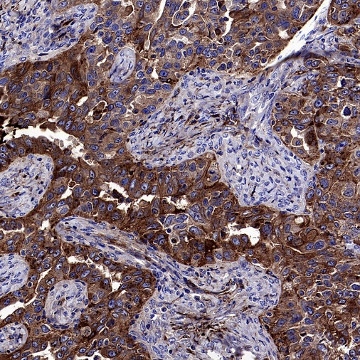 LY6E/SCA-2 Recombinant Rabbit mAb (S-2681-56)