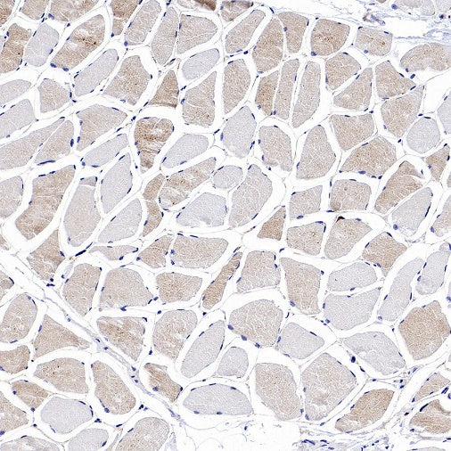 Rab11 Recombinant Rabbit mAb (S-1601-68)