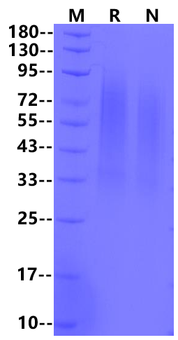 IGFBP-5 Protein, Human