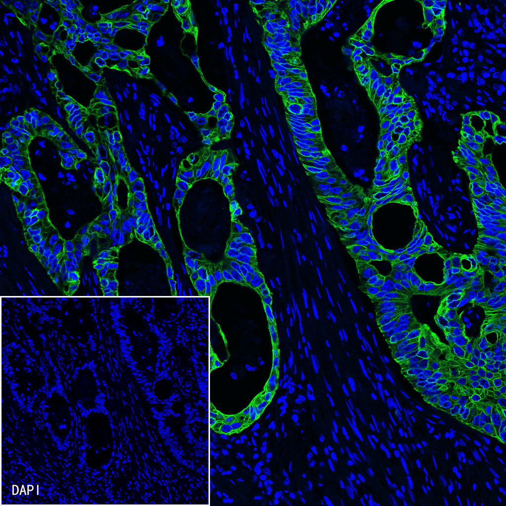 CK8/18 Recombinant Rabbit mAb,PBS Only (SDT-P005)