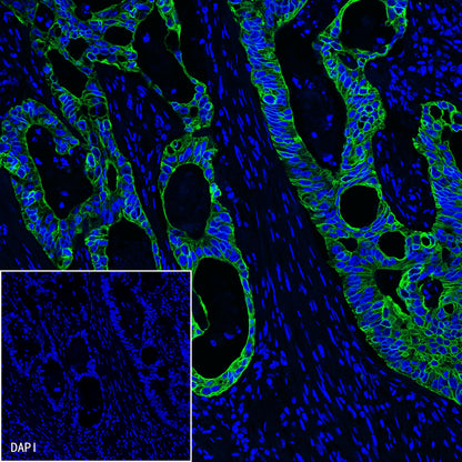 CK8/18 Recombinant Rabbit mAb,PBS Only (SDT-P005)