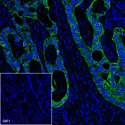 CK8/18 Recombinant Rabbit mAb,PBS Only (SDT-P005)