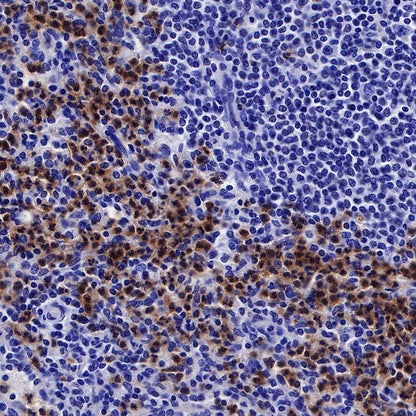 IκBα Recombinant Rabbit mAb (SDT-457-9)