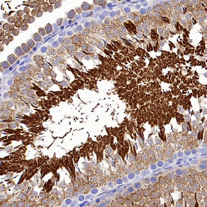 HSP70 Recombinant Rabbit mAb (S-992-39)
