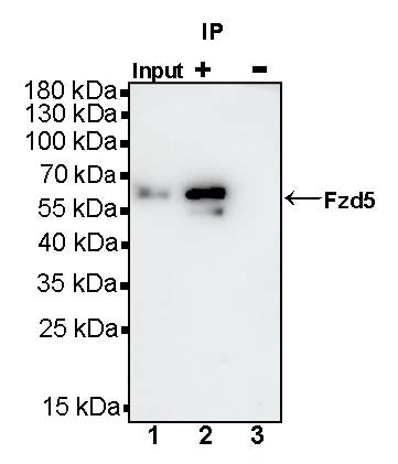 Fzd5 Recombinant Rabbit mAb (S-1511-106)