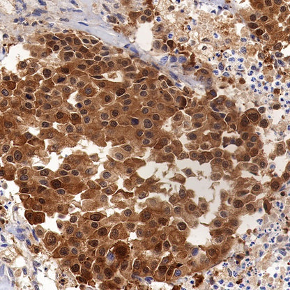 Peroxiredoxin 1/PAG Recombinant Rabbit mAb (S-1673-22)