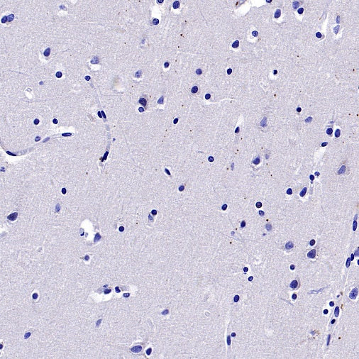 MYO7A Recombinant Rabbit mAb (S-2284-21)