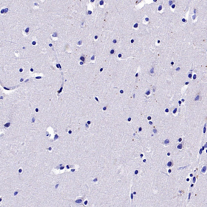 MYO7A Recombinant Rabbit mAb (S-2284-21)