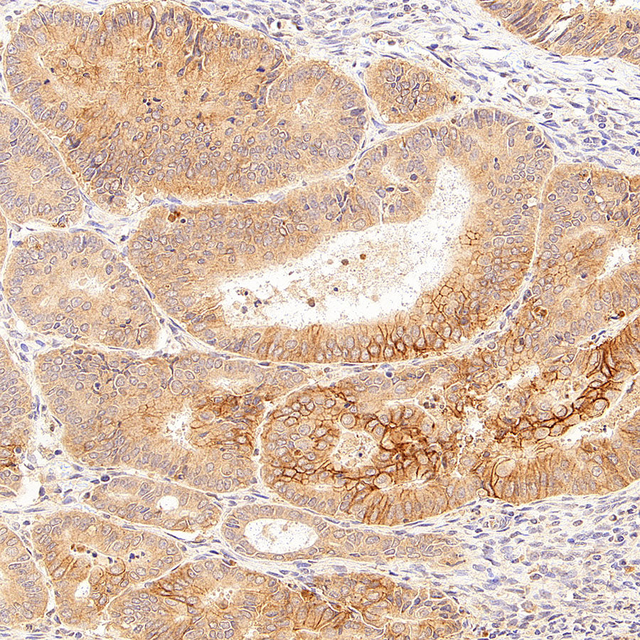 CA12 Rabbit Polyclonal Antibody