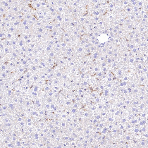 SLC40A1/Ferroportin Recombinant Rabbit mAb (S-2172-35)