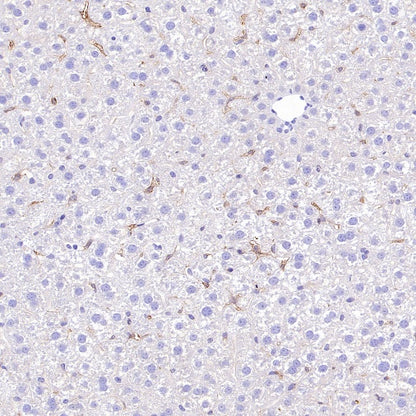 SLC40A1/Ferroportin Recombinant Rabbit mAb (S-2172-35)
