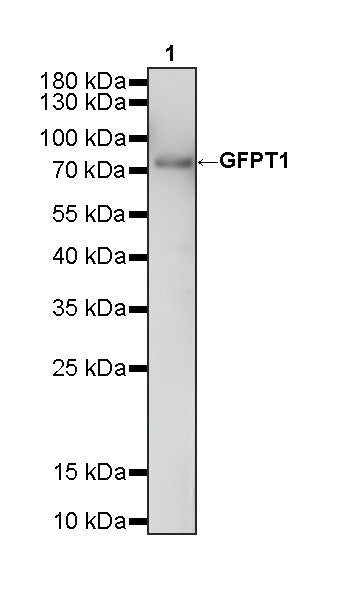 GFPT1 Recombinant Rabbit mAb (S-4752-19)