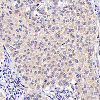 Smyd3 Recombinant Rabbit mAb (S-1507-61)