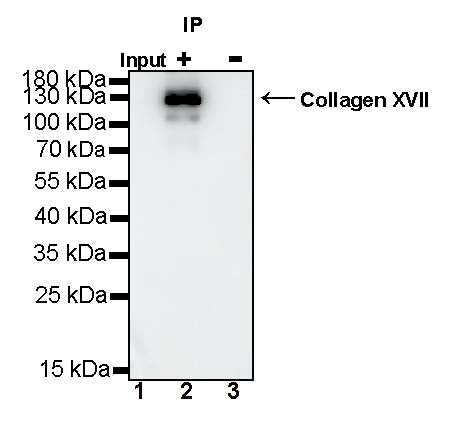 Collagen XVII Recombinant Rabbit mAb (S-1636-5)