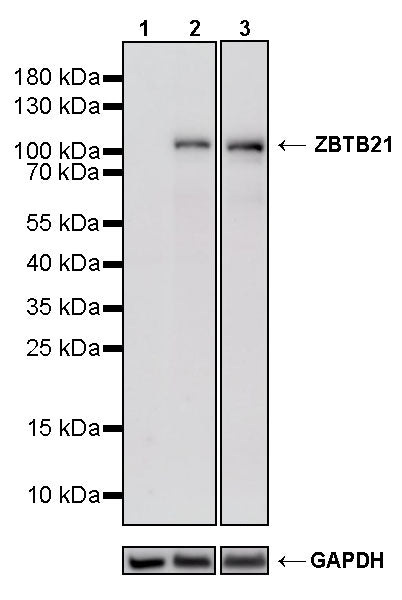 ZBTB21 Recombinant Rabbit mAb (S-3936-49)