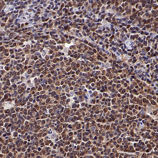 SUMO-1 Recombinant Rabbit mAb (S-625-111)