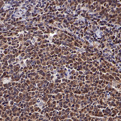 SUMO-1 Recombinant Rabbit mAb (S-625-111)