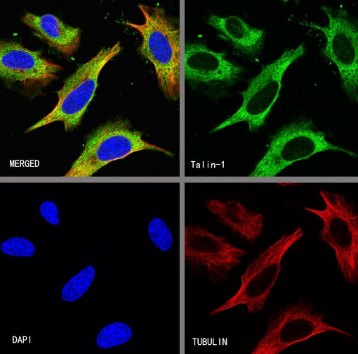 Talin-1 Recombinant Rabbit mAb (S-1483-25)