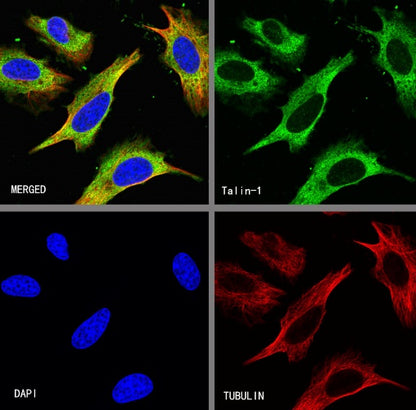 Talin-1 Recombinant Rabbit mAb (S-1483-25)
