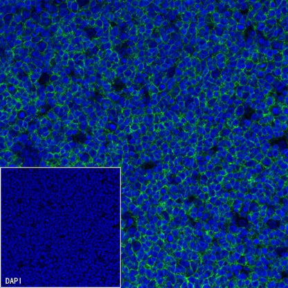 CD20 Recombinant Rabbit mAb (Alexa Fluor® 488 Conjugate) (S-R133)