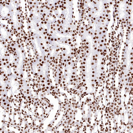 SP1 Recombinant Rabbit mAb (S-3073-71)