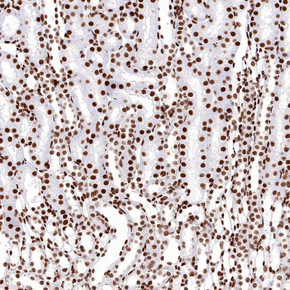 SP1 Recombinant Rabbit mAb (S-3073-71)