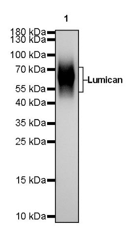 Lumican Recombinant Rabbit mAb (S-247-47)