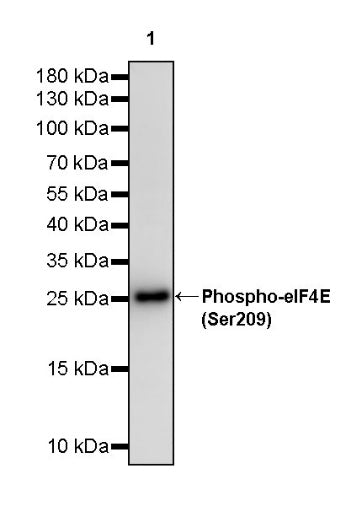 Phospho-eIF4E (Ser209) Recombinant Rabbit mAb (S-2652-195)
