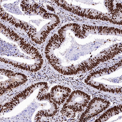 HDAC2 Recombinant Rabbit mAb (S-1474-27)