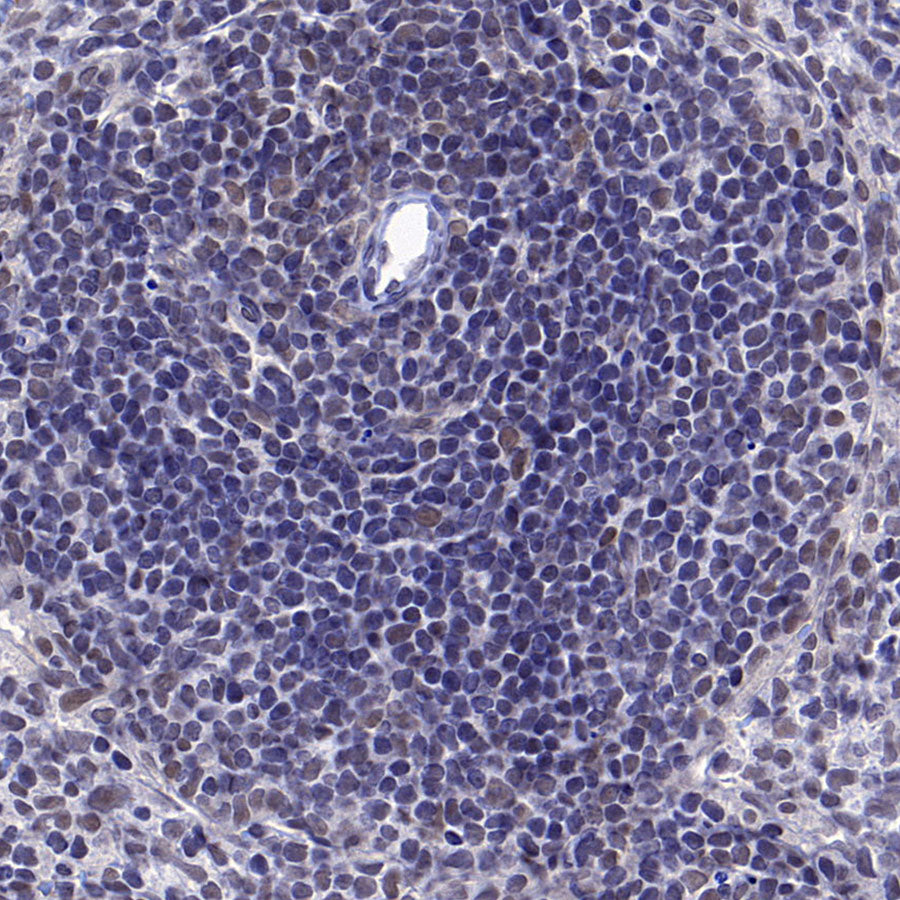 Caspase-8 Recombinant Rabbit mAb (S-2676-121)