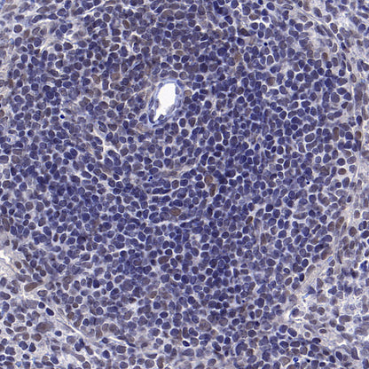 Caspase-8 Recombinant Rabbit mAb (S-2676-121)