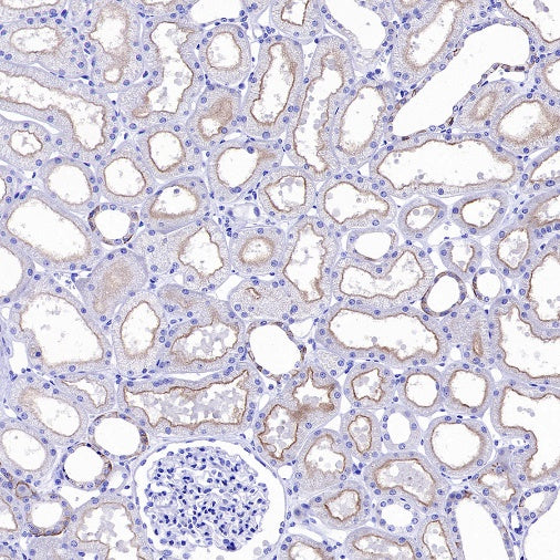 Mrp4 Recombinant Rabbit mAb (S-2305-17)