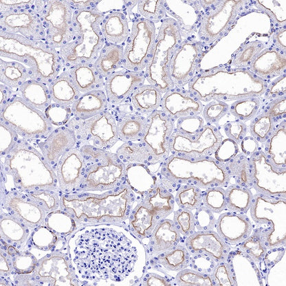 Mrp4 Recombinant Rabbit mAb (S-2305-17)