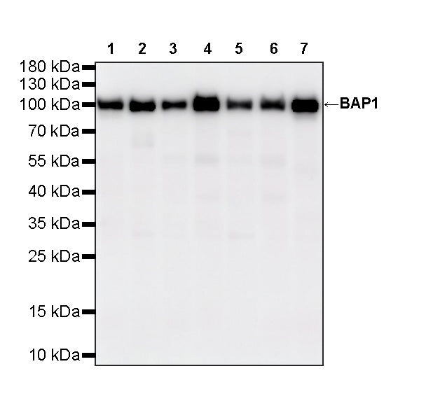 BAP1 Recombinant Rabbit mAb (S-6199)