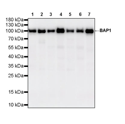 BAP1 Recombinant Rabbit mAb (S-6199)