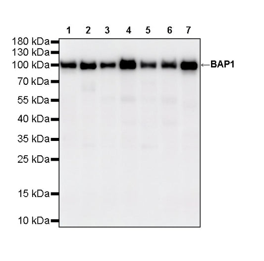 BAP1 Recombinant Rabbit mAb (S-6199)