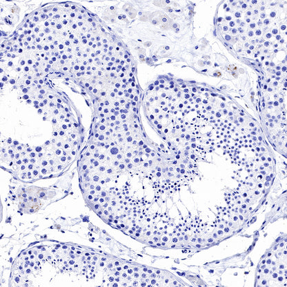OCT3/4 Recombinant Rabbit mAb (SDT-165-76)