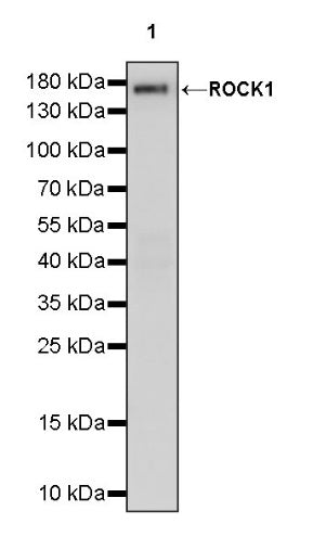 ROCK1 Recombinant Rabbit mAb (S-1304-153)