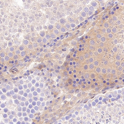 Phospho-YAP (Ser127) Recombinant Rabbit mAb (S-4250)